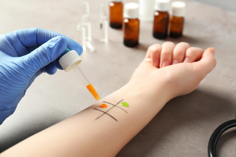 doctor prescribing skin testing to test for drug allergies